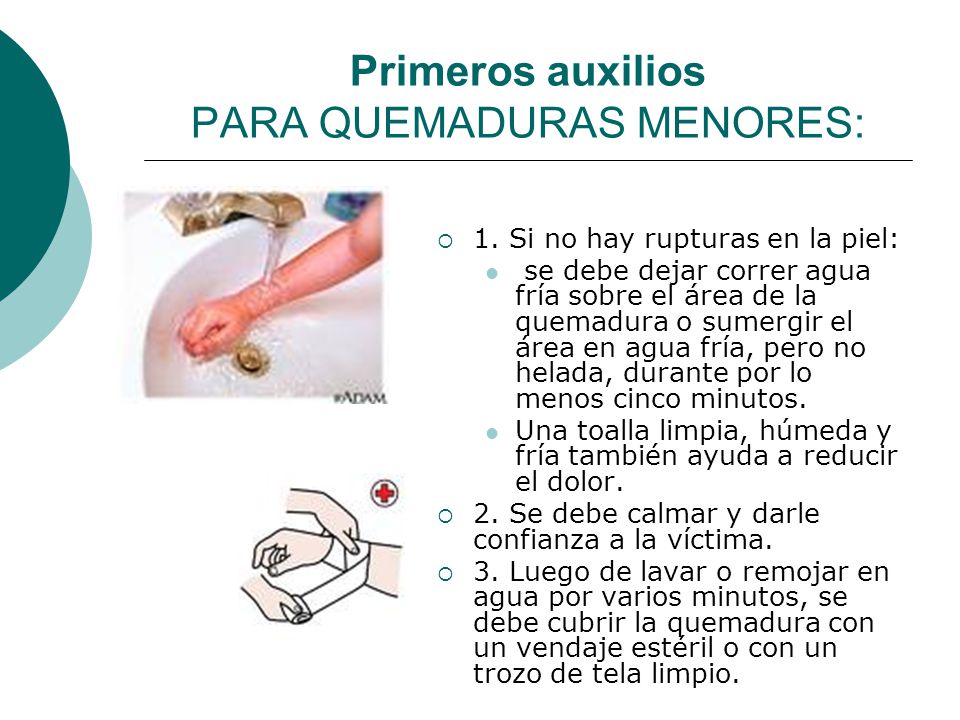 De primeros quemaduras en cuales auxilios son los caso